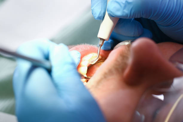 Best Mobile Emergency Dentist in Medina, NY