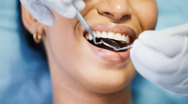 Best Broken or Cracked Tooth Emergency Dentist in Medina, NY