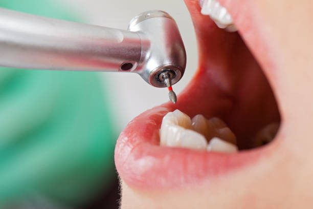 Best Urgent Dental Care for Toothache in Medina, NY